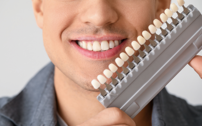 Can I Get Veneers if My Natural Teeth Are Crooked