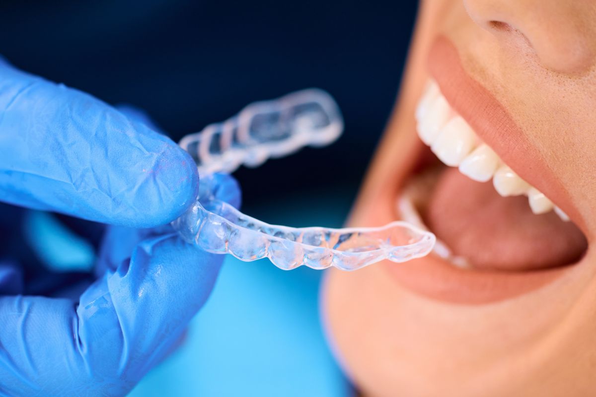 invisalign in castro valley