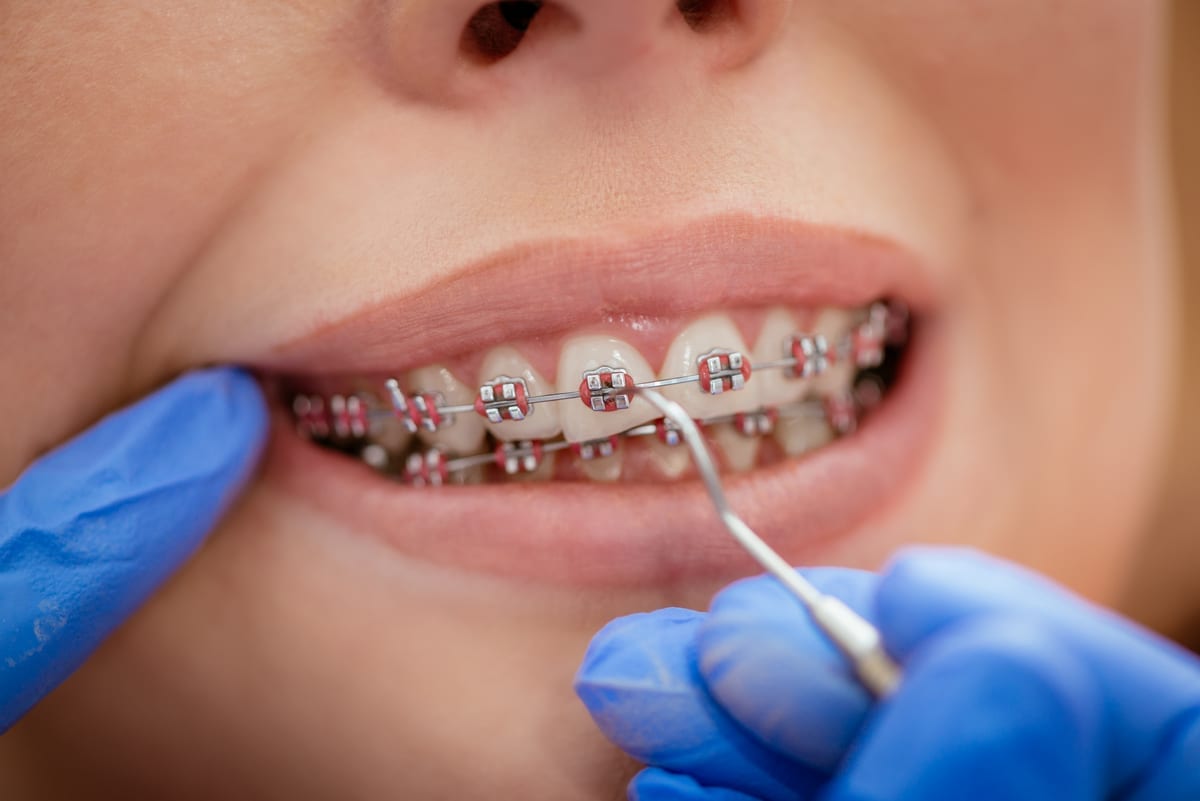 Restorative Dentistry in Cherryland